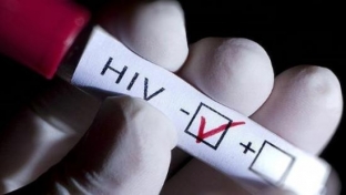 В Югре снижается заболеваемость ВИЧ