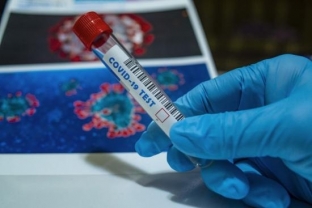 Россияне смогут пожаловаться на задержку тестов на коронавирус