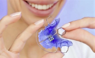 Как исправить прикус с помощью ортодонтических аппаратов