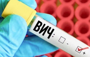 Специалисты заявили об эпидемии ВИЧ в Югре