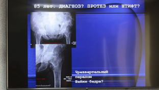 Сургутские травматологи в лечении переломов бедра используют современные технологии