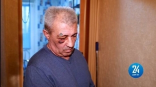 В Сургуте мужчину избили сантехники, приехавшие устранять коммунальную аварию