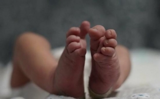 Врачи из Нижневартовска спасли новорожденную с редкой патологией